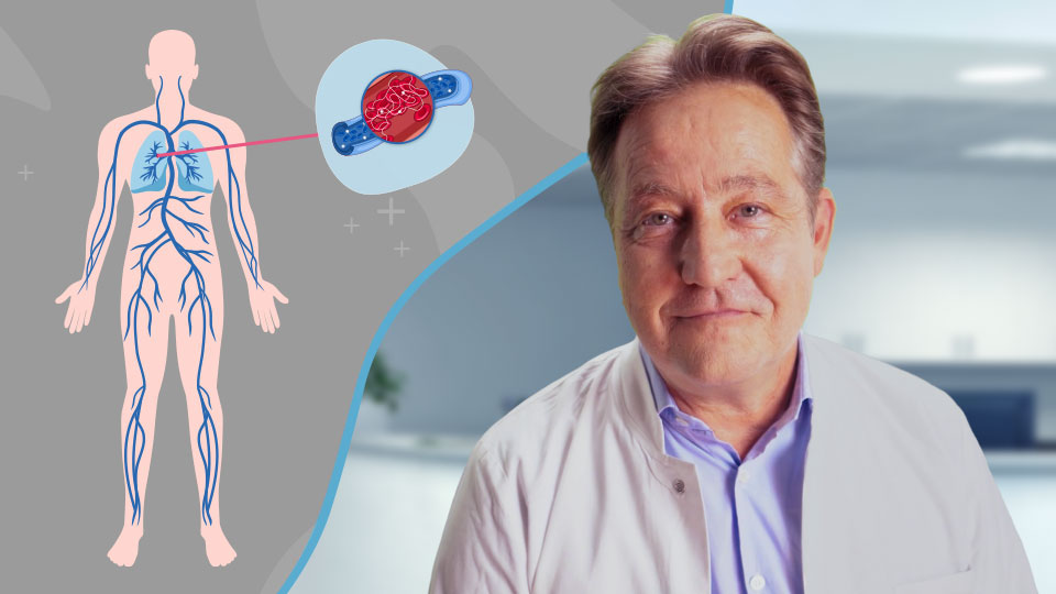 Vorschaubild zum Kurs: Venöse Thrombosen: Symptome, Diagnostik und Prävention