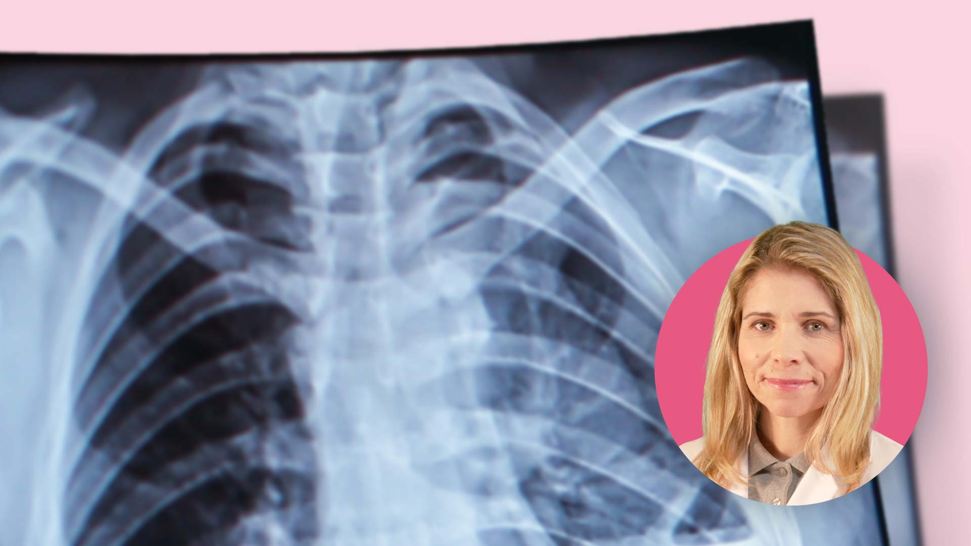 Vorschaubild zum Kurs: Chronisch obstruktive Lungenerkrankung (COPD): Effektive Inhalations- und Medikationsstrategien